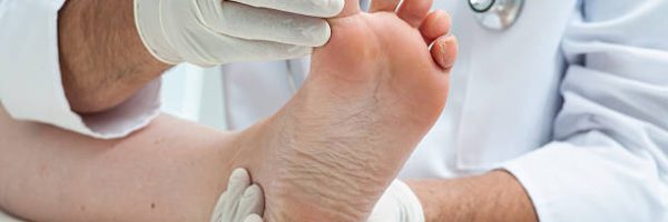 Doctor dermatologist examines the foot on the presence of athlete's foot